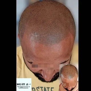 Hair Loss treatment =
Instant Results 💯
-
-
-
💬Are you bald or have Thinning hair?
💬Do you want t