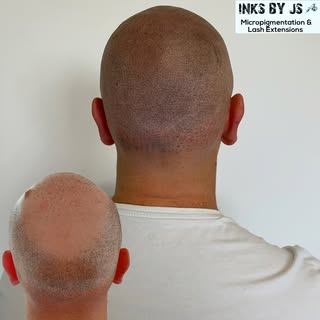Another amazing result that looks very natural and the tattoo blends perfectly with his skin shaved 