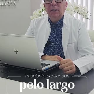 ¿Sientes que el tamaño de tu frente aumenta? Gracias a un trasplante capilar es posible reducir la l