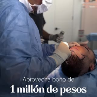 ¡Recupera tu pelo y tu imagen! Aprovecha un espectacular bono de UN MILLÓN DE PESOS en tu trasplante