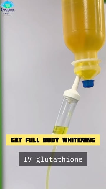 IV glutathione @smaavins #chennai #vadapalani #fullbodywhitening #glowingskin