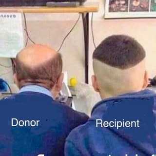 💈 When the donor meets the perfect recipient...

In hair transplant terms, this would be a match ma
