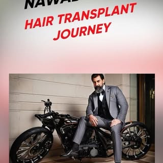 Embark on Nawab Shah’s transformative hair transplant journey. Witness the journey to confidence, re