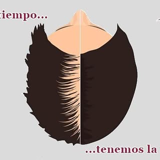 Estás a tiempo. Ven a Mariano García. Estamos en Calle Luis Montoro, 107, 3H
#caidadepelo #problemas