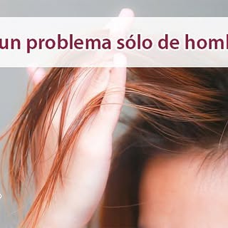 La #alopecia no es sólo cosa de hombres.
Especialistas en todos los tratamientos para #problemascapi