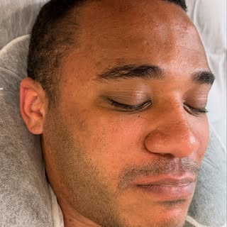 ✨ A fuller-looking beard without looking overdone. Natural results, tailored to you.

📍Indianapolis