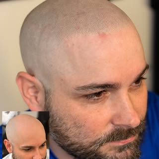 Two sessions later you can achieve a nice seamless shade for any shave 🙌🏼

📍 Indianapolis, IN
📩 