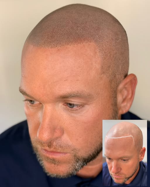 Driving from Louisville to Indy for his five year touchup along with a slight adjustment to his hair