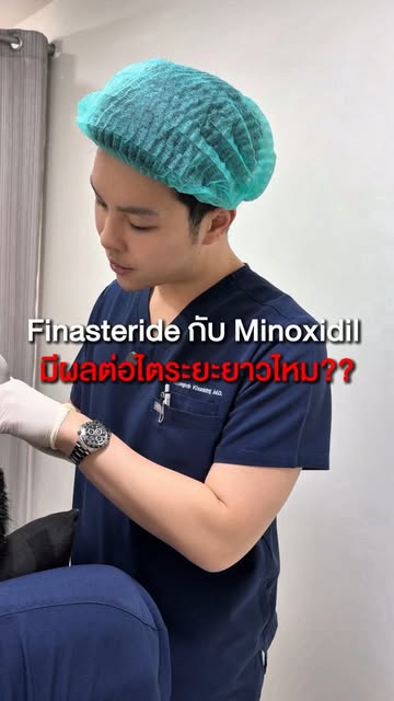 Finasteride กับ Minoxidil มีผลต่อไตไหม #minoxidil #finasteride #บํารุงเส้นผม