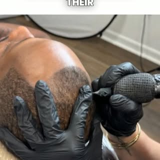 Regain Your Confidence with Scalp Micropigmentation (SMP)Tired of hair loss affecting how you feel a