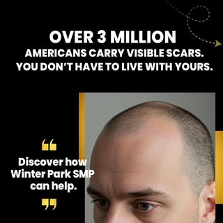 ✨ Scar Camouflage with SMP ✨
Did you know scalp micropigmentation can blend scars seamlessly into yo