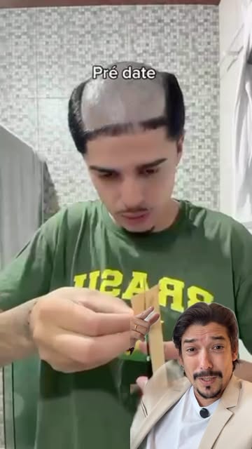 Prótese capilar para quem ainda não precisa? Isso pode ser um perigo!