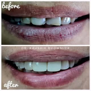 A confident smile can change everything. ✨

This case was completed using artistically layered free-