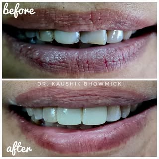 A confident smile can change everything.

This case was completed using artistically layered free-ha
