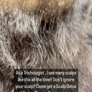 As a Trichologist , I see many scalps like this all the time!! Don’t ignore your scalp!! Come get a 