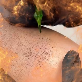 Get that 🔥🔥 scalp micropigmentation at Edge Scalp Ink😎

EDGE SCALP INK
Get your edge back.

Check