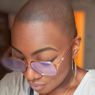 😱🥹Unbelievable transformation for this Parisian woman suffering from alopecia. She definitely got 