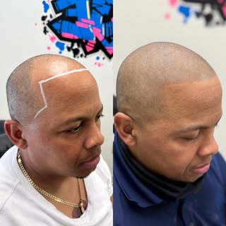Scalp Micropigmention magic 🪄🎩 

EDGE SCALP INK
Get your edge back.

Check out our site for more i