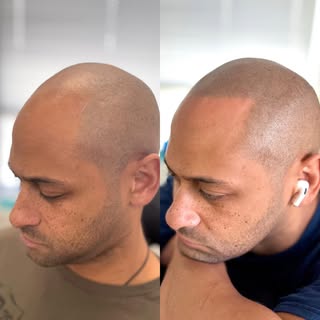 Your face is a painting and your hairline is the frame. Get the picture? 🖼️ 😎 

EDGE SCALP INK
Get