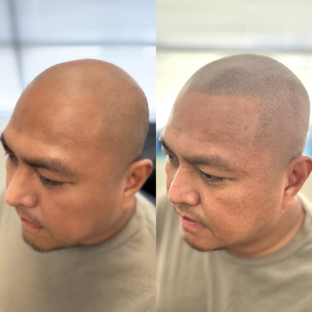 Only two✌️sessions for this man to get his edge back 😎. Medium soft and natural hairline ☑️

EDGE S