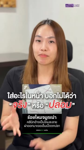 หมอเตือนภัย! #ร้อยไหม จมูกเน่า!!
.
#คลินิกเสริมความงาม #ร้อยไหมจมูก