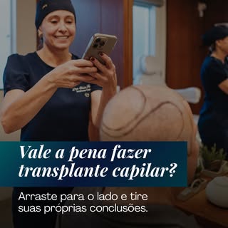 Vale a pena fazer transplante capilar?
Quando olhamos para o antes e o depois nossos transplantes  c