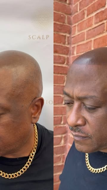 How does SMP look after a few years and what a retouch/one session does. 📍Lawrenceville, GA

#scalp