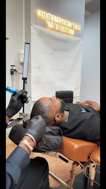 Why most hair transplant surgery needs scalp micropigmentation after. Even the ones done in Turkey.
