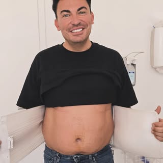 Vor zwei Wochen war @matthiasmangiapane bei uns im Ästhetik Team Nürnberg zur Hernienoperation 🙌
Je