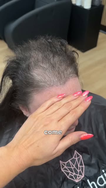 Every maintenance starts the same way with us. System off, scalp properly cleansed, hair rethreaded 