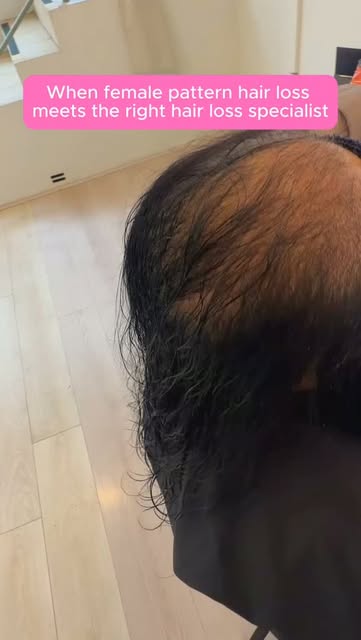Every woman deserves to feel confident in her own hair. 🤍

With the right care, a personalised appr
