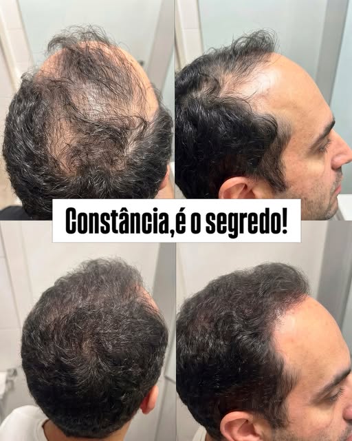 Cada evolução é fruto de cuidado e constância.

No tratamento capilar, o resultado é construído dia 