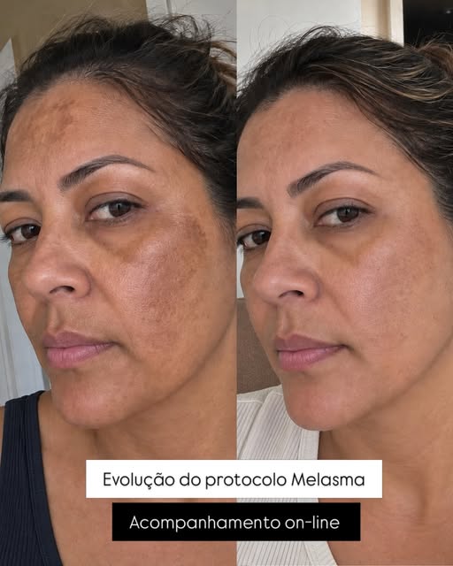 Olha essa evolução! 

Cuidado, orientação e acompanhamento fazem a diferença.

Quando a pele recebe 