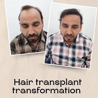"Confidence isn’t bought—it’s grown. See what’s possible at NovaSure!" This is not just a hairline—i
