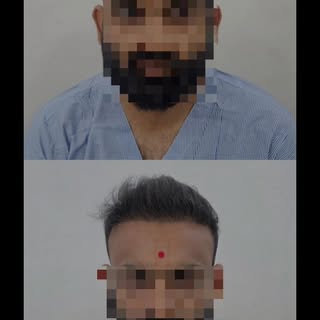 “Your transformation starts here — Novasure’s signature hair restoration.Because you deserve to feel