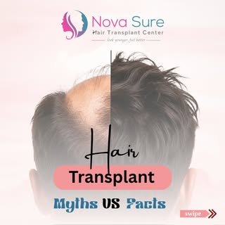 Hair Transplant Myths vs Facts ✨
Don’t let myths stop you from getting your confidence back! 
Modern
