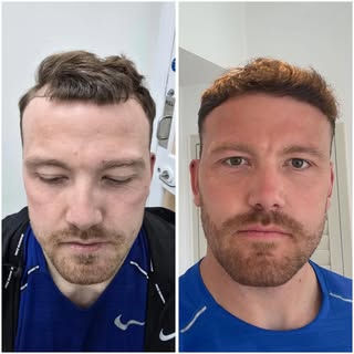 📈 7 MONTH RESULT 📈

Just look at this transformation, and such early progress. 

If you want a tra