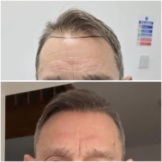 From thinning to thriving. 📈

Every transformation tells a story, and this is one we’re proud to sh