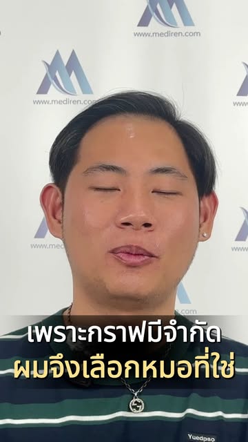 “เพราะกราฟต์ผมมีจำกัด จึงต้องเลือกหมอที่ใช่” 💙✨
อัปเดตความมั่นใจของคุณนัท 
หลังดูแลปัญหาเส้นผมครบ 1
