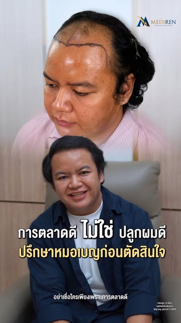 💡 การตลาดที่ว่าดี... 
อาจไม่เท่าผลลัพธ์ที่ตอบโจทย์!
"อย่าเพิ่งเชื่อใครเพียงเพราะการตลาด 
ลองเข้ามาป