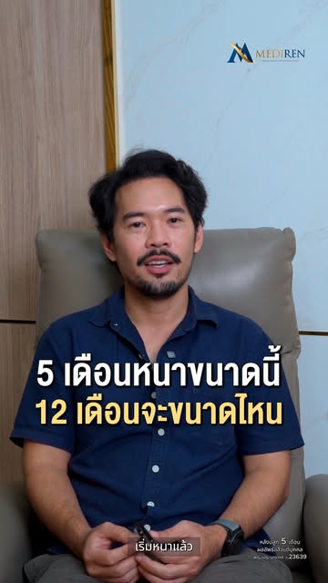อัปเดตผลลัพธ์ 5 เดือน! 
คืนความมั่นใจ ด้วยไรผมที่ดูเป็นธรรมชาติ 💙
จากปัญหาแนวผมร่นลึกรูปตัว M 
ที่ก