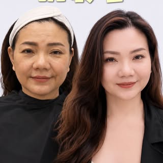 医美的两条思路：抗衰和重塑五官
本质都是，让自己更舒服和自信地看见自己🥰

✨这位45+的妈妈和我们说“我不要变成另一个人，不要假，只想自然地变年轻”

📩如果你有同个烦恼，欢迎私讯我们了解属于你