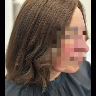 #femalehairloss #londonhairsystem #meshintegrationsystem #hairlossolution #nonsurgicalhairreplacemen