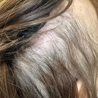 #femalehairloss #londonhairsystem #meshintegrationsystem #hairlossolution #hairsystem