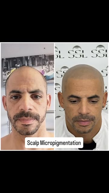 Check out this amazing SMP transformation ✨

My client came in for a touch-up and a slightly darker 