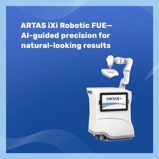 Our ARTAS iXi Robotic FUE system represents the most advanced approach to surgical hair restoration 