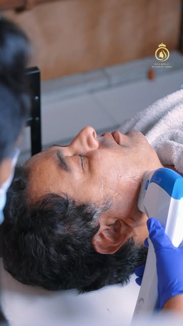 When results speak for themselves, trust follows.

Actor Subodh Bhave undergoing HIFU Skin Tightenin