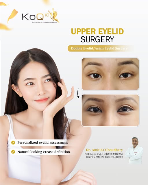 ✨✨✨ Upper Eyelid Enhancement (Blepharoplasty)✨✨✨
------- Now In Jaigaon -------- Dr. Amit Kr. Choudh