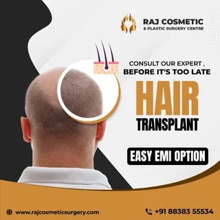 Hair transplant surgery is a procedure used to treat hair loss. 
It is a good option for hair loss t
