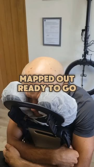 👉 Kent SMP Hair Loss Clinic

Designing the client's hairline is always an important part of the pro